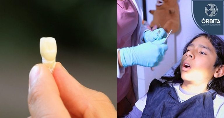 Niños entre los 3 y los 9 años son los más vulnerables a sufrir traumatismos dentales