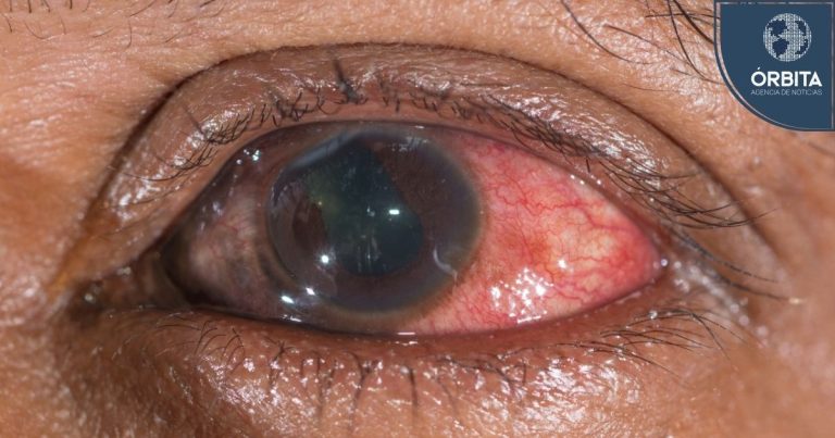 Lesiones en el ojo son frecuentes en casa y el trabajo a pesar de que la mayoría son prevenibles