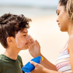 Advierten sobre alto riesgo de sufrir quemaduras solares por la radiación solar extremadamente alta en el país