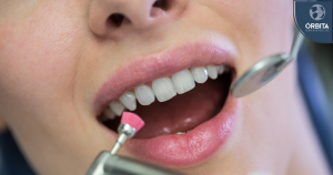 Blanqueamiento dental: qué sí funciona, qué no y qué puede dañar sus dientes